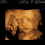 Elijah's Ultrasound Pictures taken at 28 weeks.